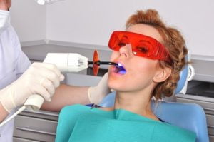 How to Care for Teeth after a Filling