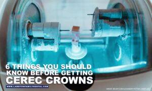 6 Things You Should Know
